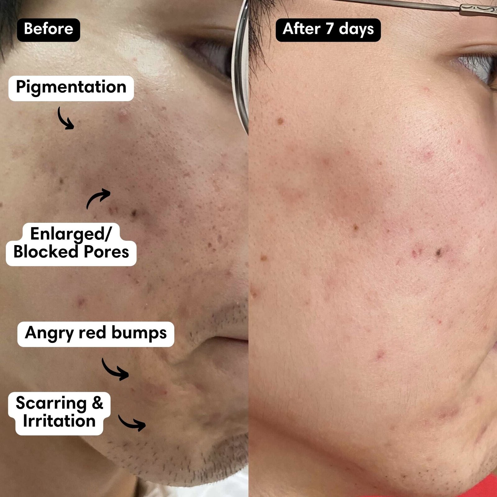 Brightening Facial Massage Set - Image 4