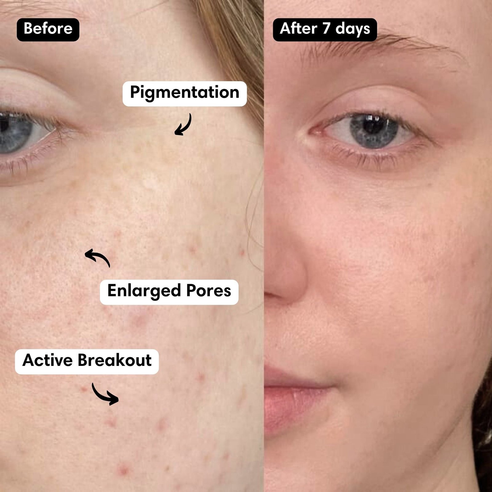 Complete Brightening Exosome Kit - Image 4